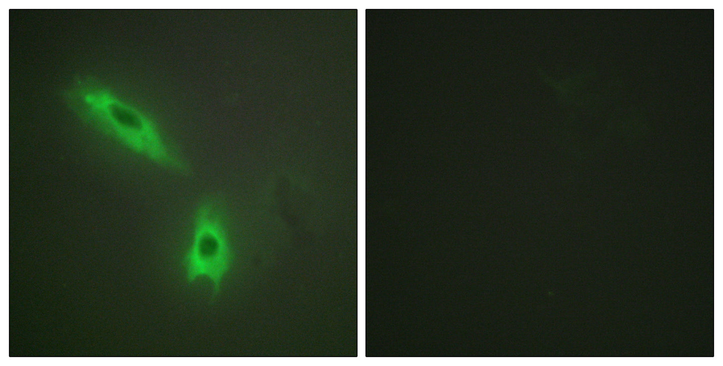 LT-β Rabbit Polyclonal Antibody