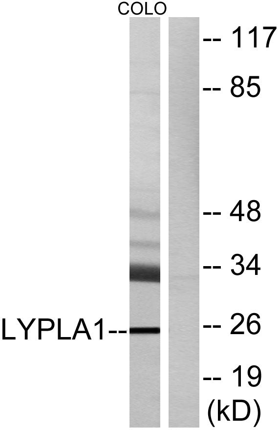 LYPLA1 Rabbit Polyclonal Antibody