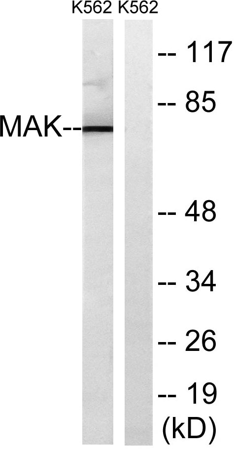 MAK Rabbit Polyclonal Antibody
