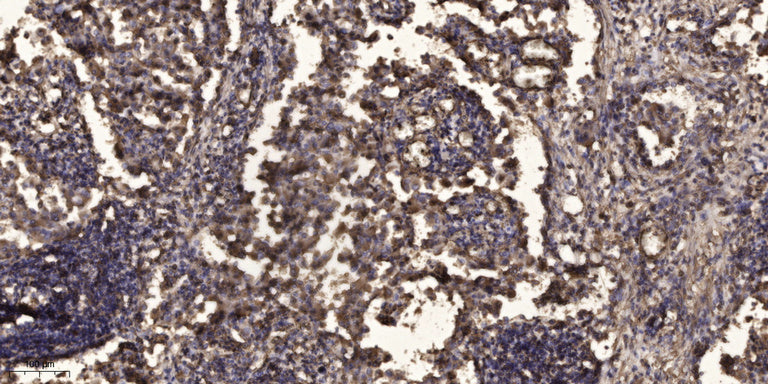 MAP1B Rabbit Polyclonal Antibody