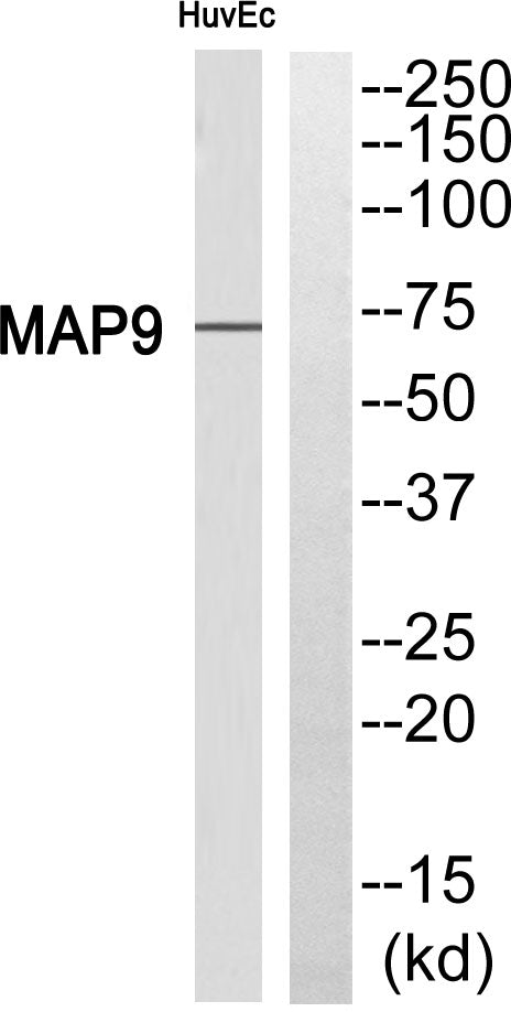 MAP-9 Rabbit Polyclonal Antibody