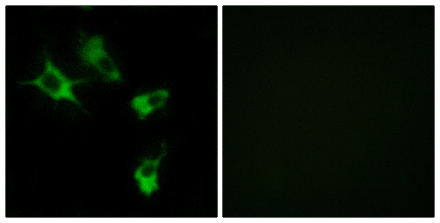 MAST4 Rabbit Polyclonal Antibody