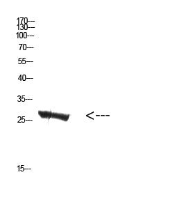 MBL-C Rabbit Polyclonal Antibody