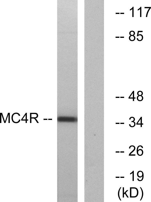 MC4-R Rabbit Polyclonal Antibody
