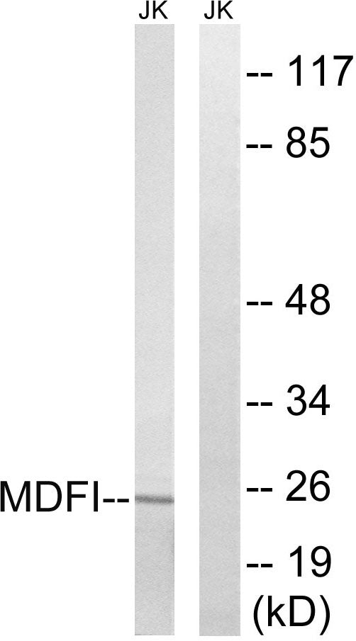 MDFI Rabbit Polyclonal Antibody