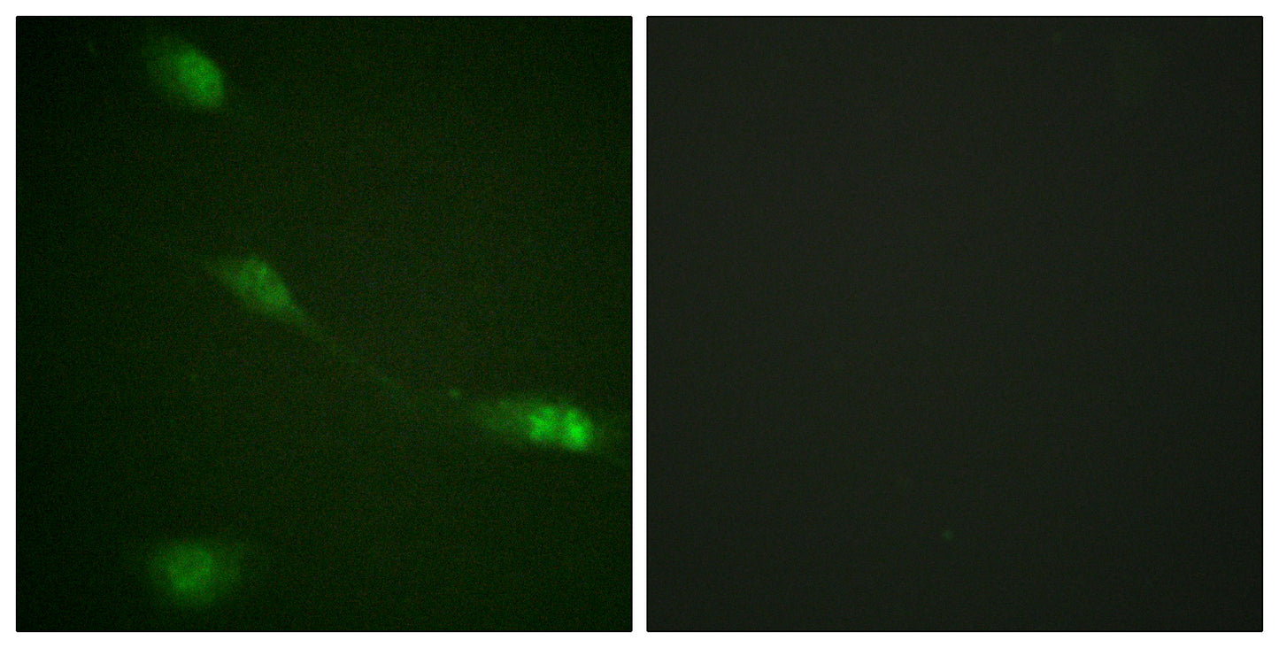 MDM2 Rabbit Polyclonal Antibody