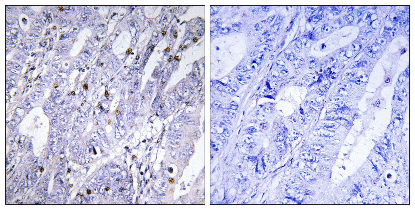 MEF-2D Rabbit Polyclonal Antibody