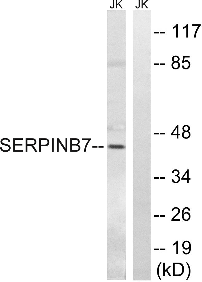 Megsin Rabbit Polyclonal Antibody