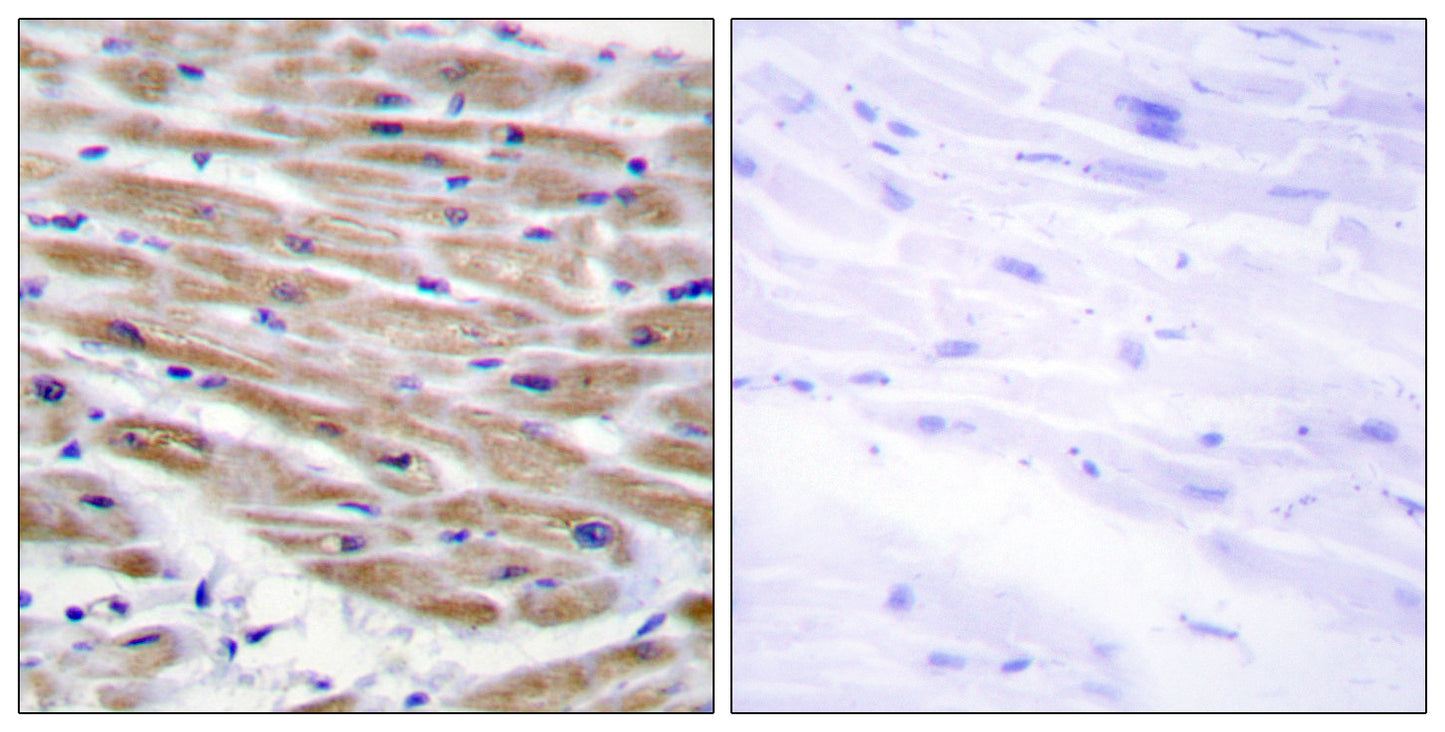 MEK Kinase-4 Rabbit Polyclonal Antibody