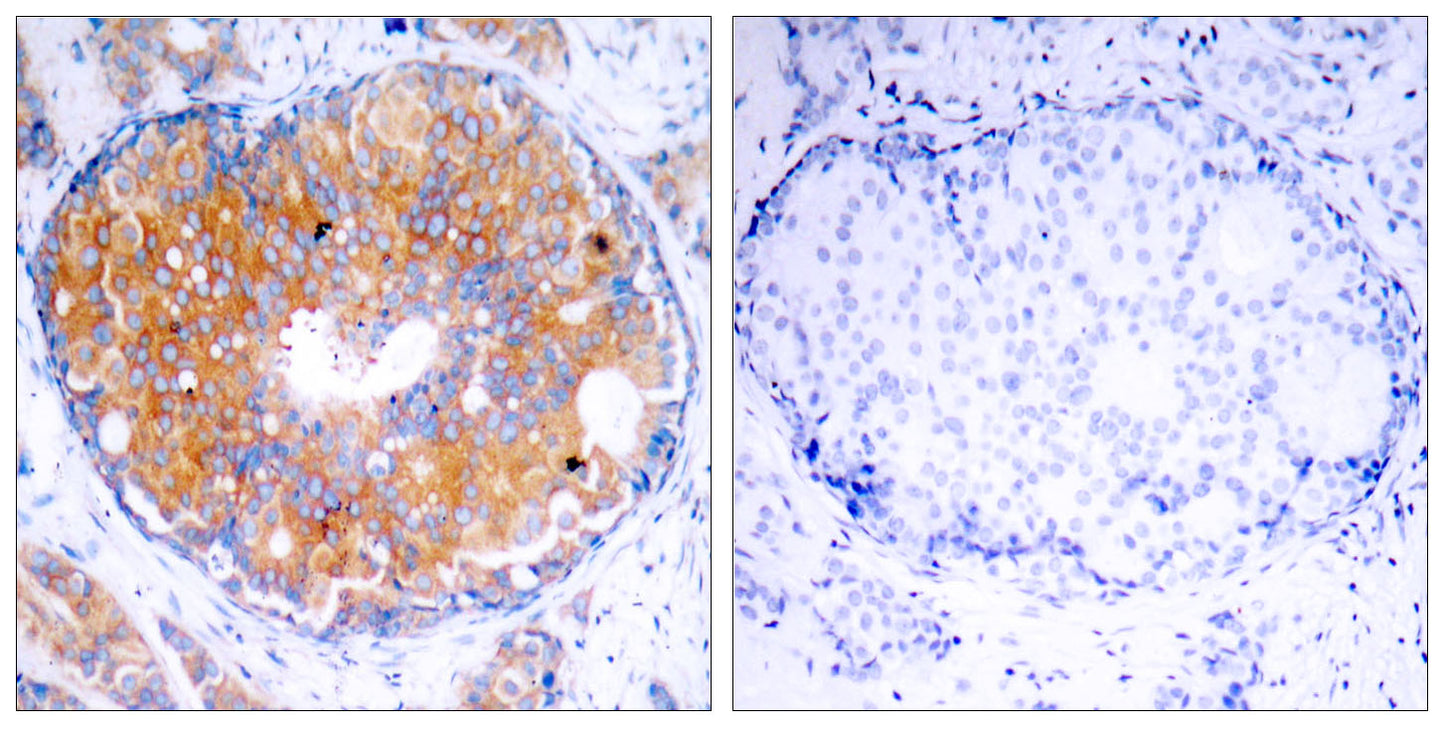 MEK-2 Rabbit Polyclonal Antibody