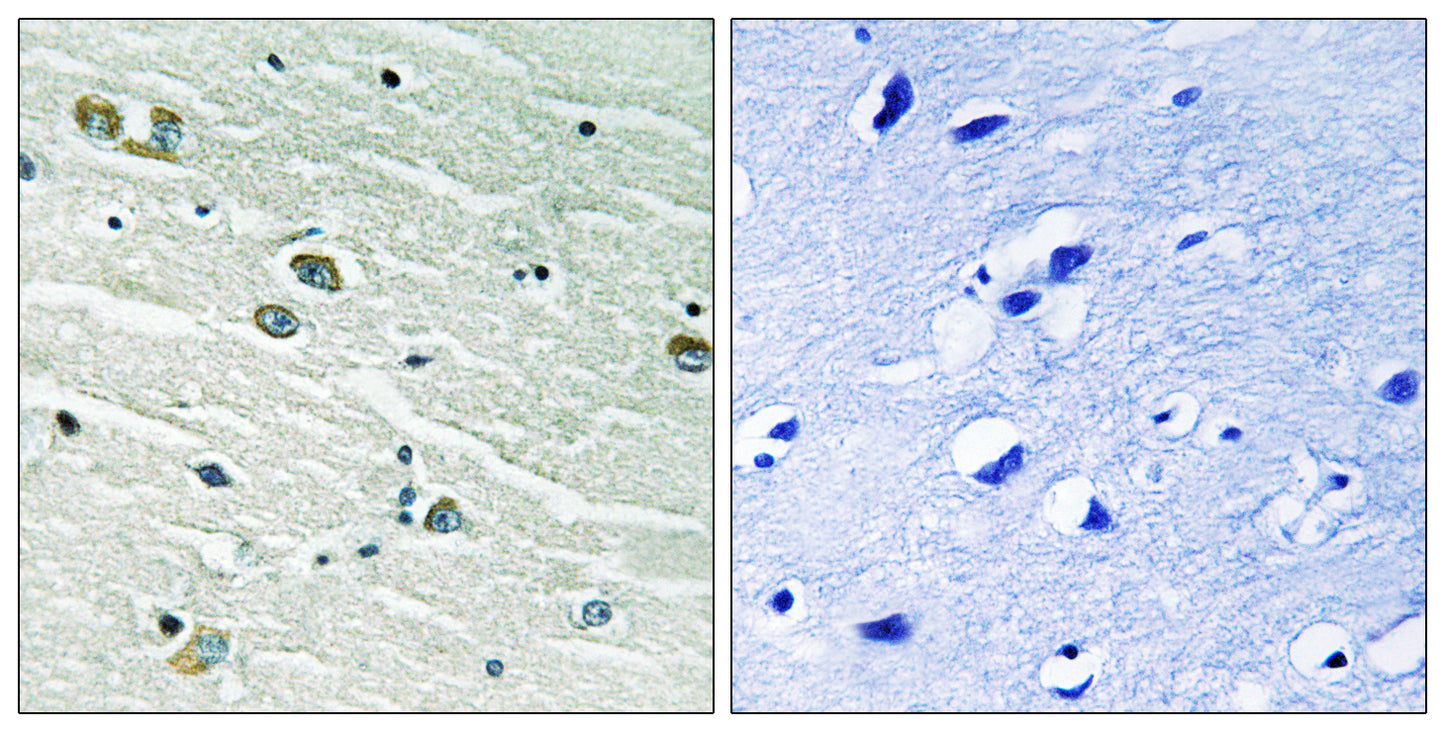 MerTK/Tyro3 Rabbit Polyclonal Antibody