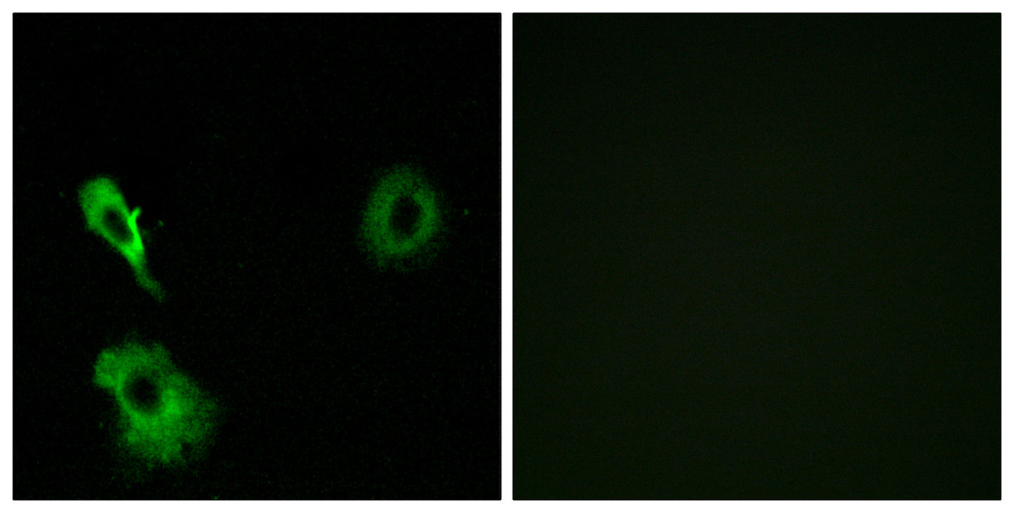 mGluR7 Rabbit Polyclonal Antibody