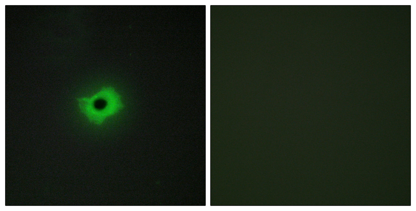 MIC2 Rabbit Polyclonal Antibody