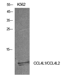 MIP-1b Rabbit Polyclonal Antibody
