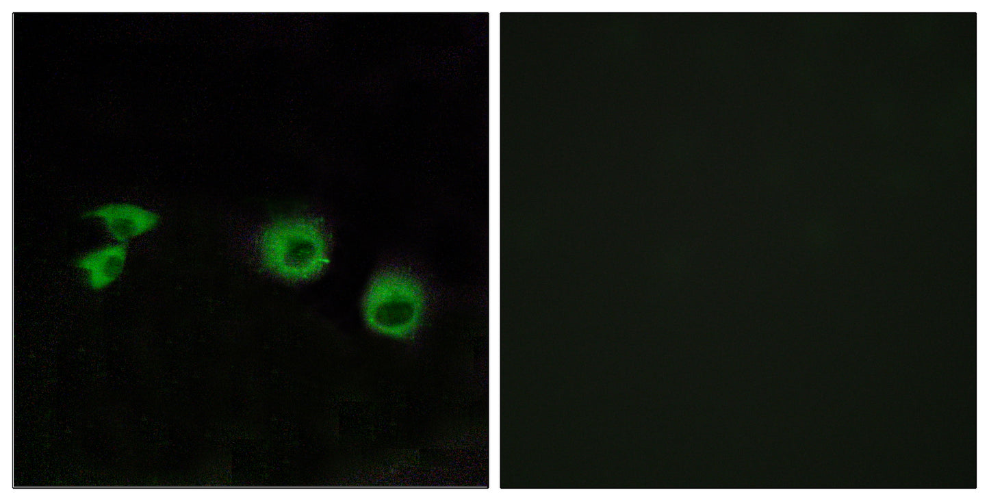 MIP-T3 Rabbit Polyclonal Antibody