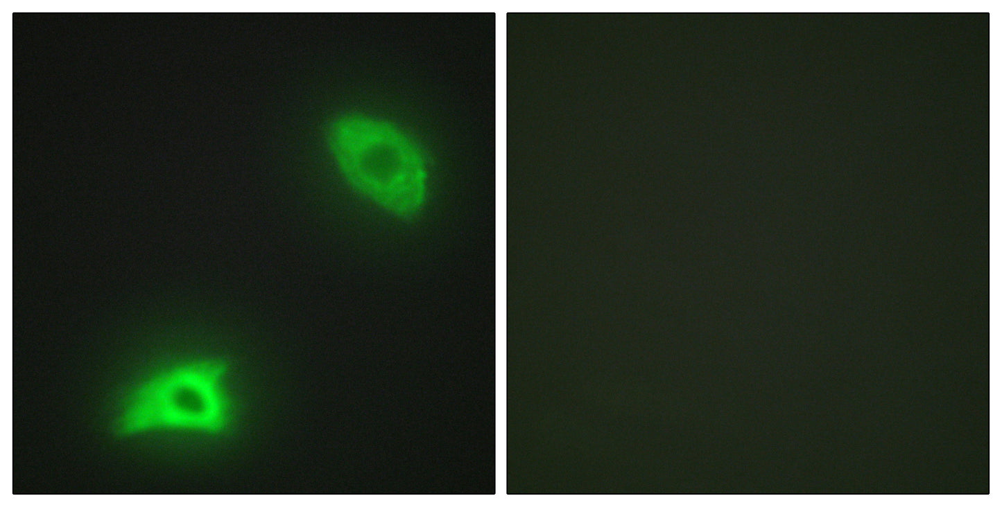 MKP-3 Rabbit Polyclonal Antibody