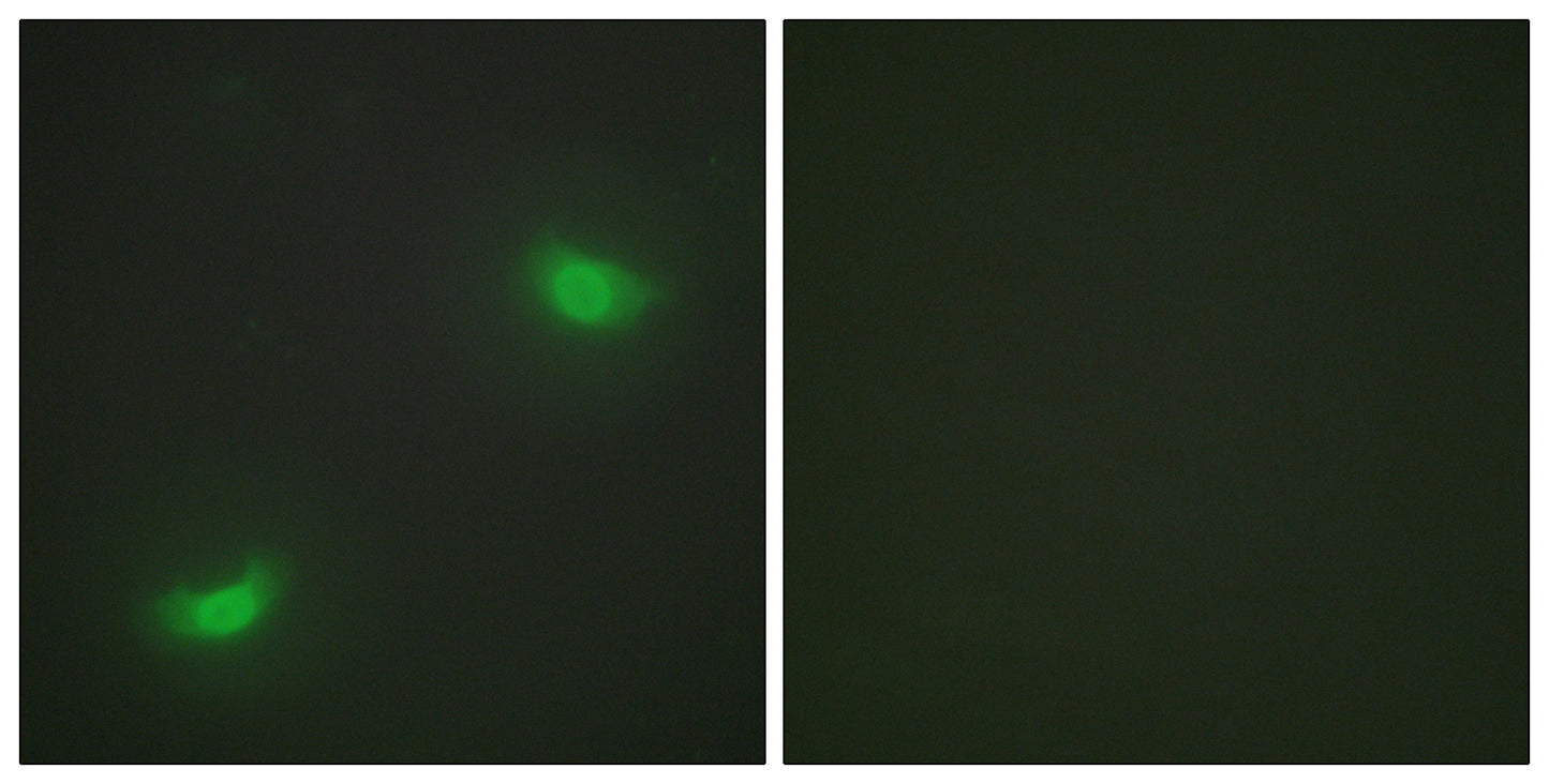 MKP-7 Rabbit Polyclonal Antibody