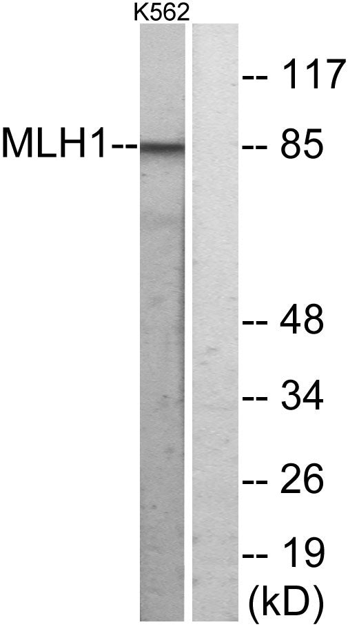 MLH1 Rabbit Polyclonal Antibody