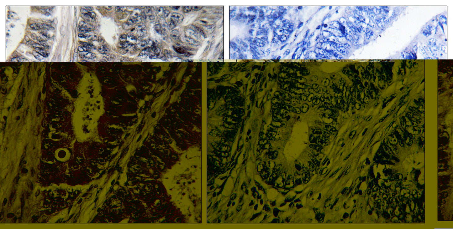 MLK1 Rabbit Polyclonal Antibody