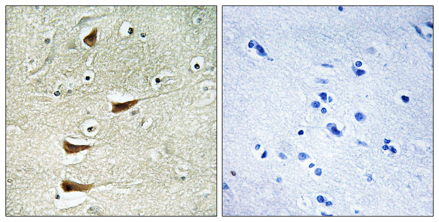 MLK2 Rabbit Polyclonal Antibody
