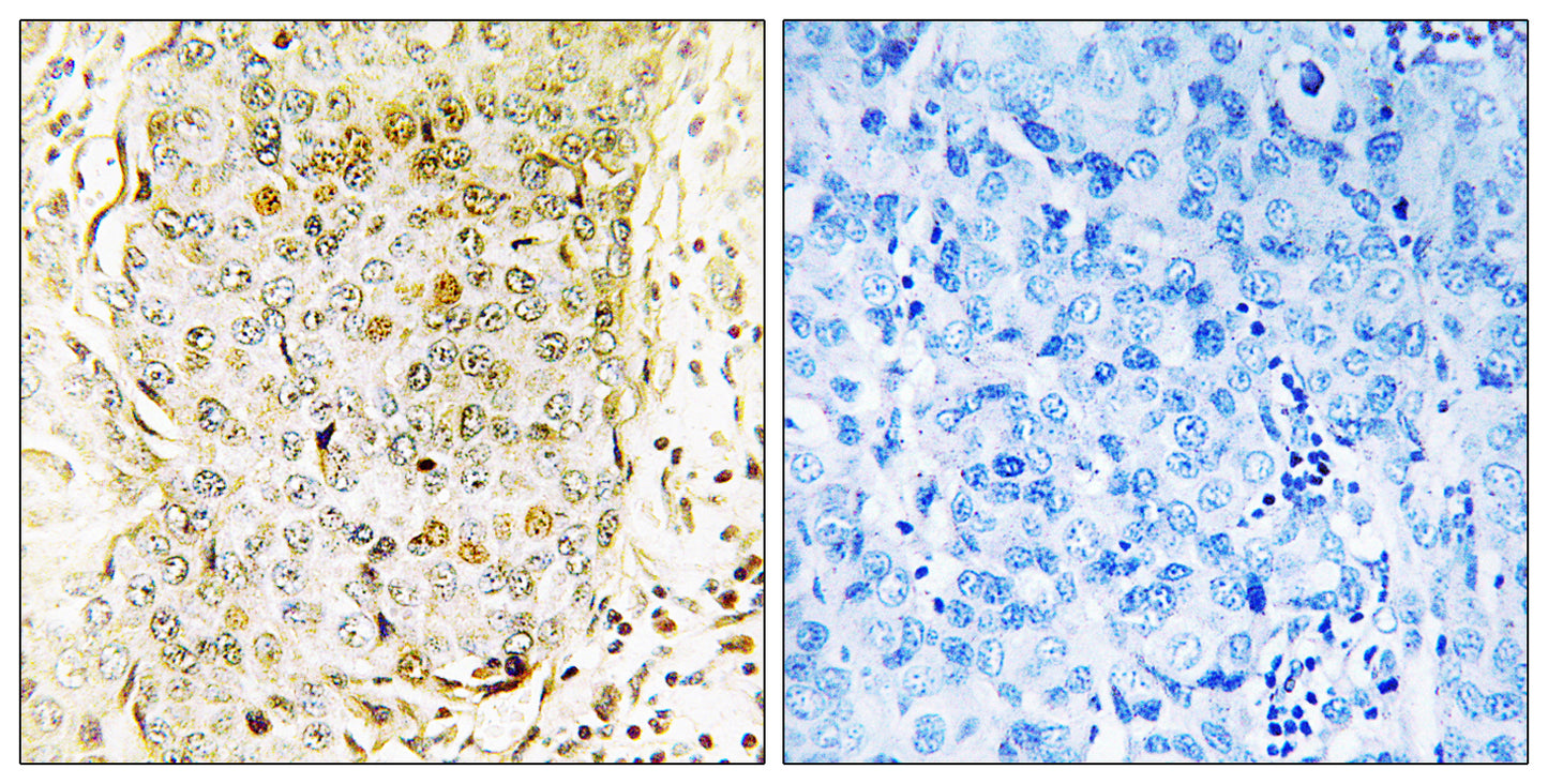MLK3 Rabbit Polyclonal Antibody