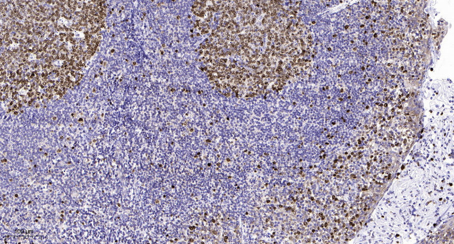 MLL4 Rabbit Polyclonal Antibody