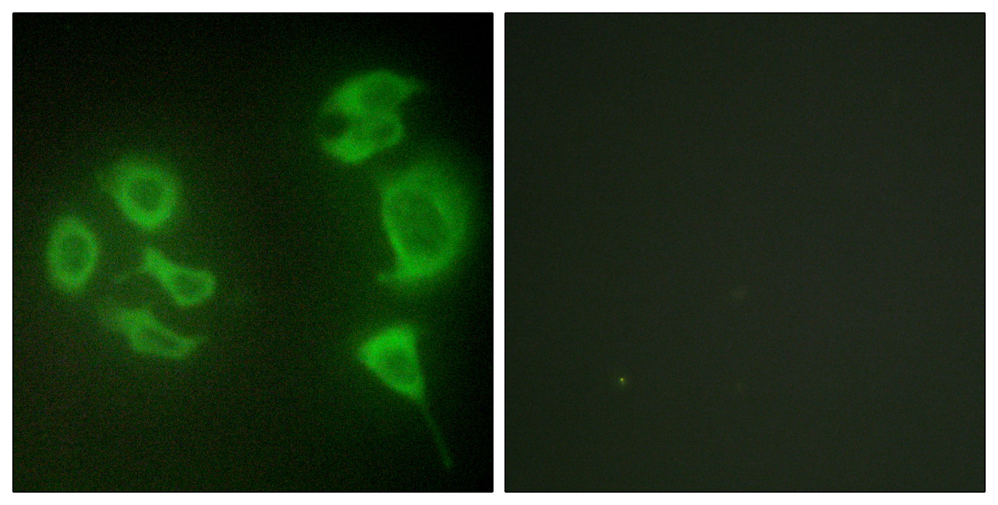 MLTK Rabbit Polyclonal Antibody