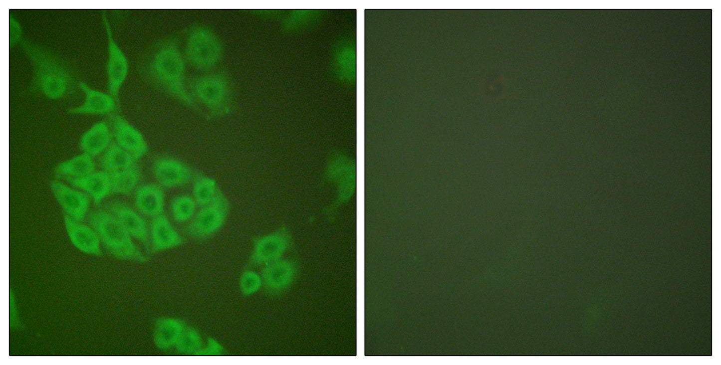 MMP-11 Rabbit Polyclonal Antibody
