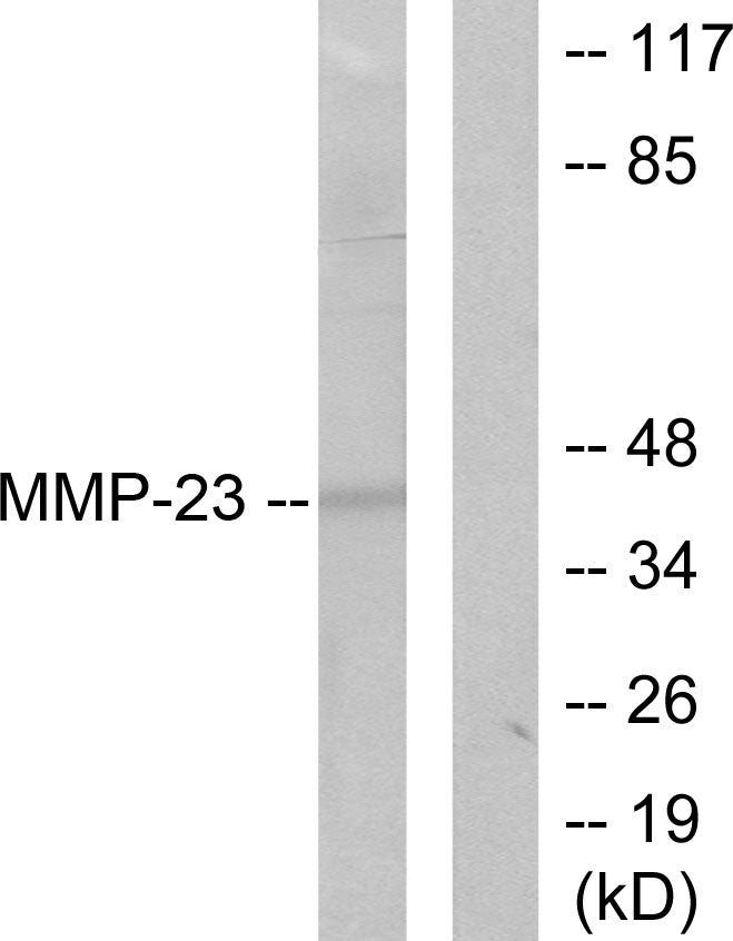 MMP-23 Rabbit Polyclonal Antibody