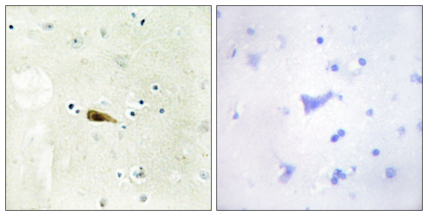 MOF Rabbit Polyclonal Antibody