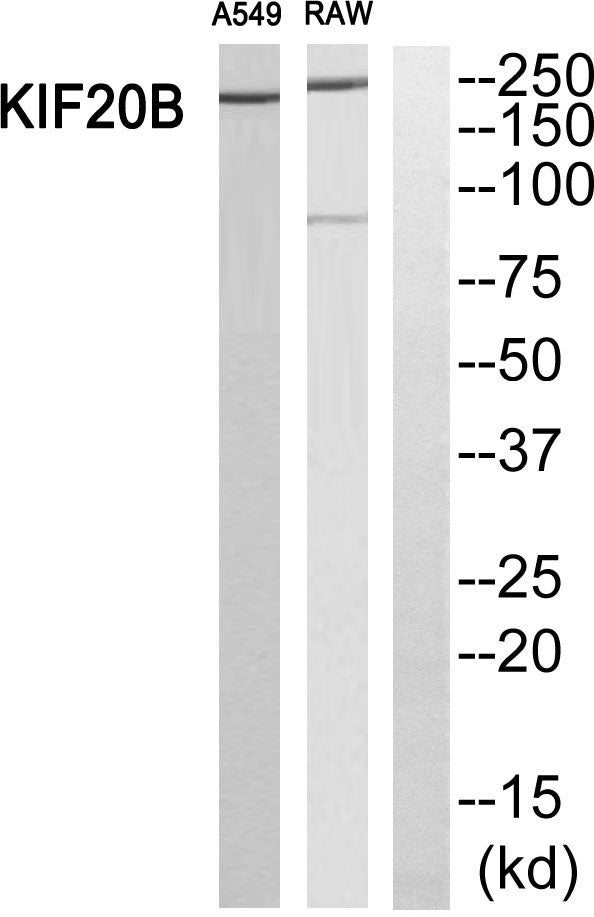 MPP1 Rabbit Polyclonal Antibody