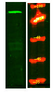 MPP8 Rabbit Polyclonal Antibody