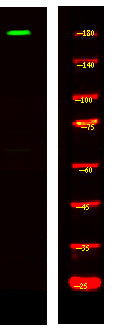 MRCKG Rabbit Polyclonal Antibody