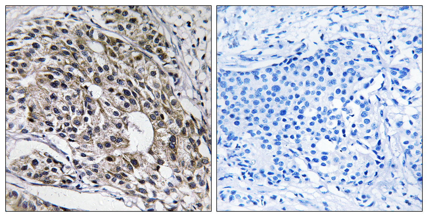 MRP-L13 Rabbit Polyclonal Antibody