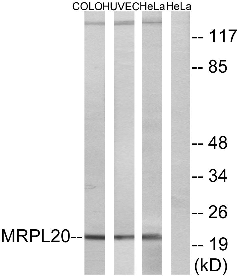 MRP-L20 Rabbit Polyclonal Antibody