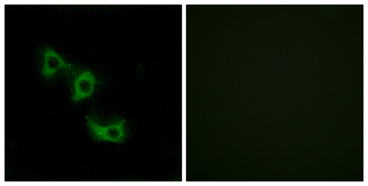 MRP-L44 Rabbit Polyclonal Antibody