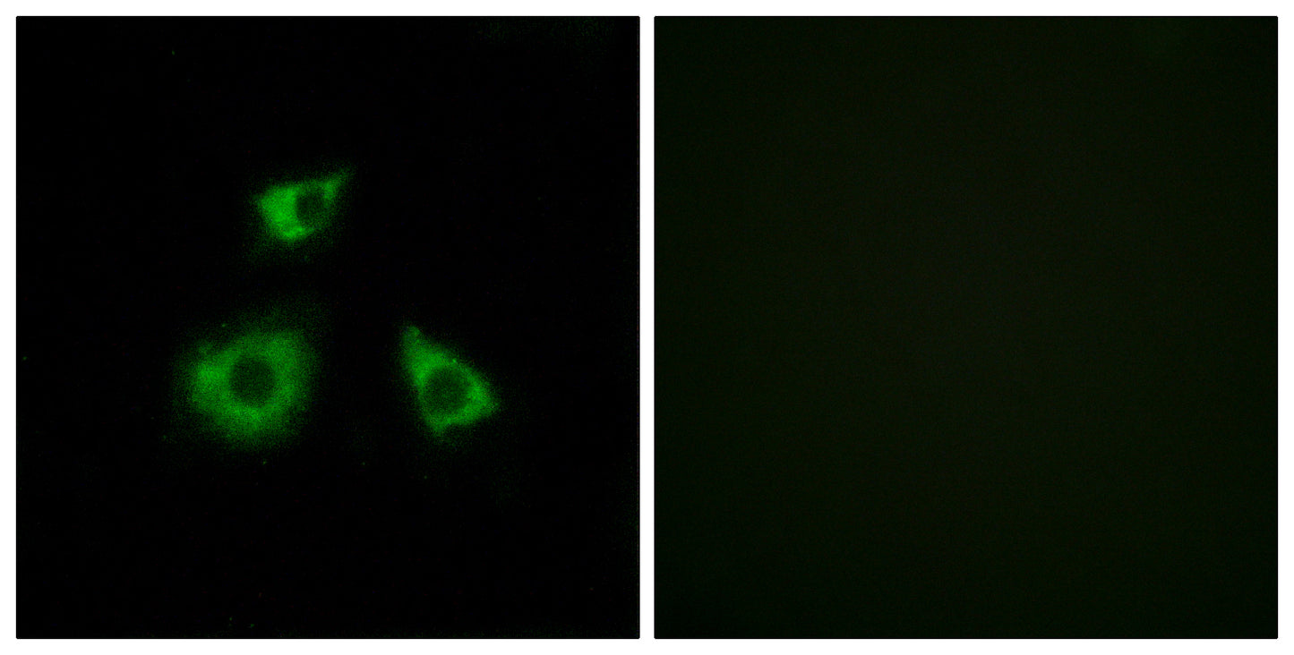 MRP-L52 Rabbit Polyclonal Antibody