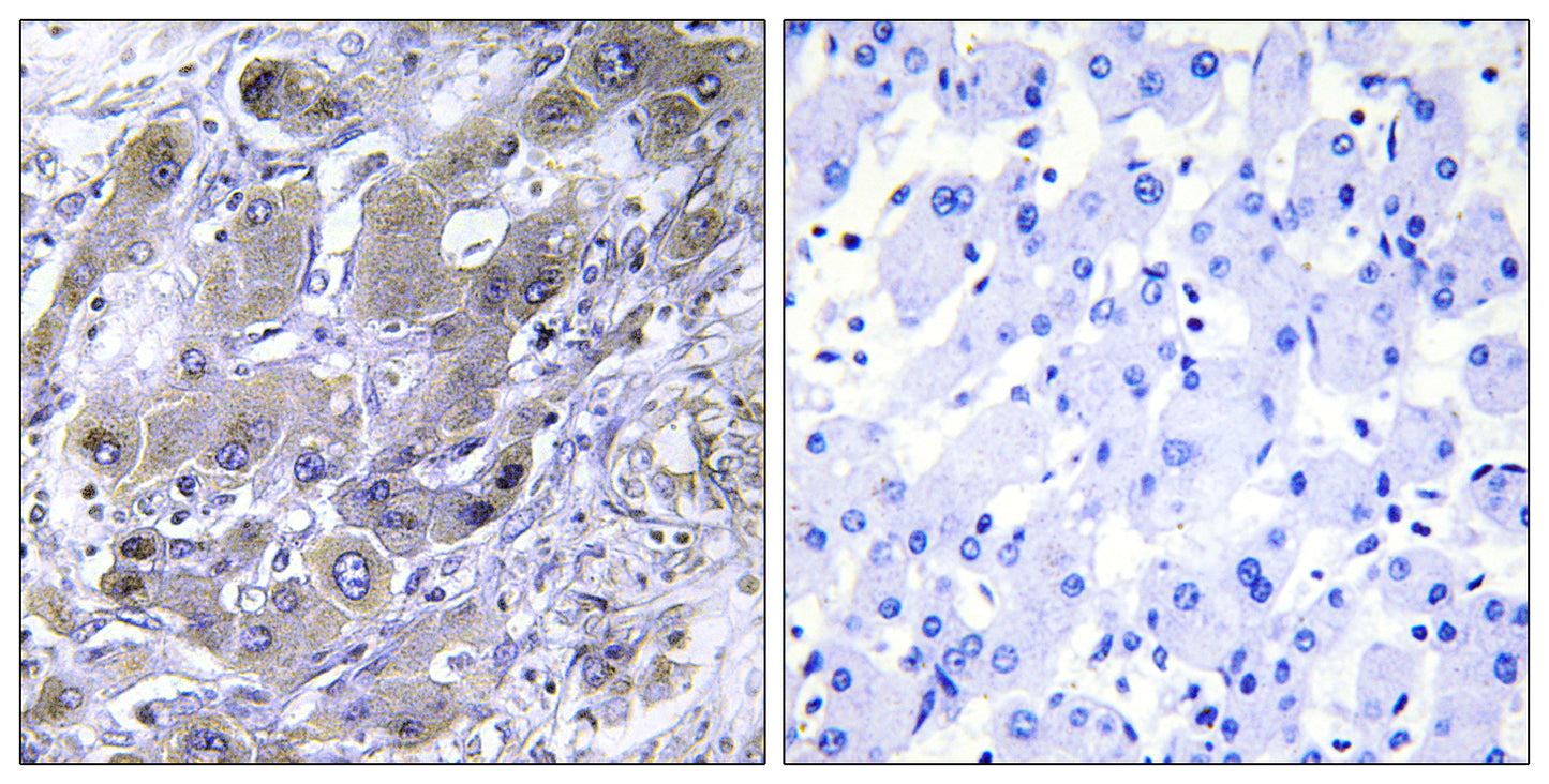 MRP-S18A Rabbit Polyclonal Antibody