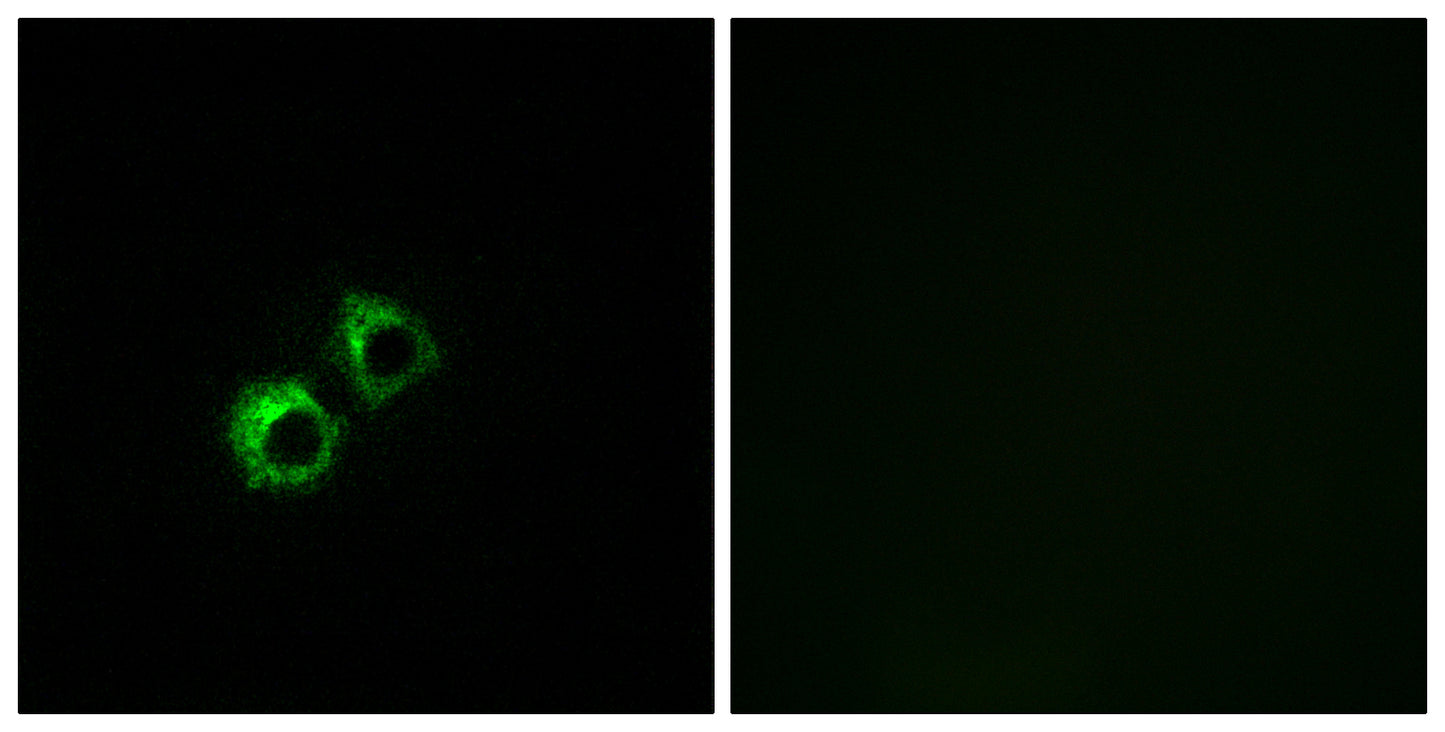 MRP-S21 Rabbit Polyclonal Antibody