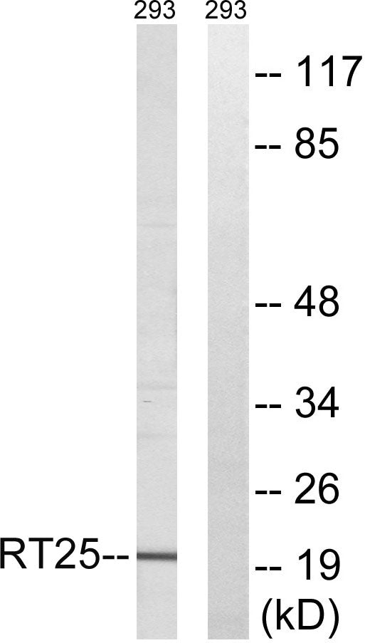 MRP-S25 Rabbit Polyclonal Antibody