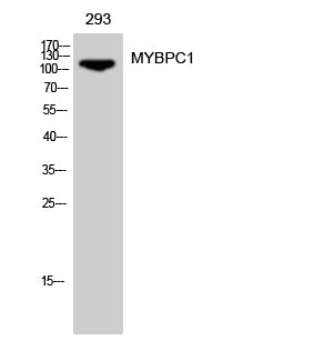 MYBPC1 Rabbit Polyclonal Antibody