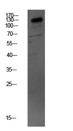 MYBPC3 Rabbit Polyclonal Antibody