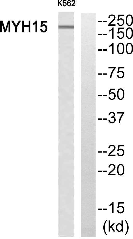 MYH15 Rabbit Polyclonal Antibody