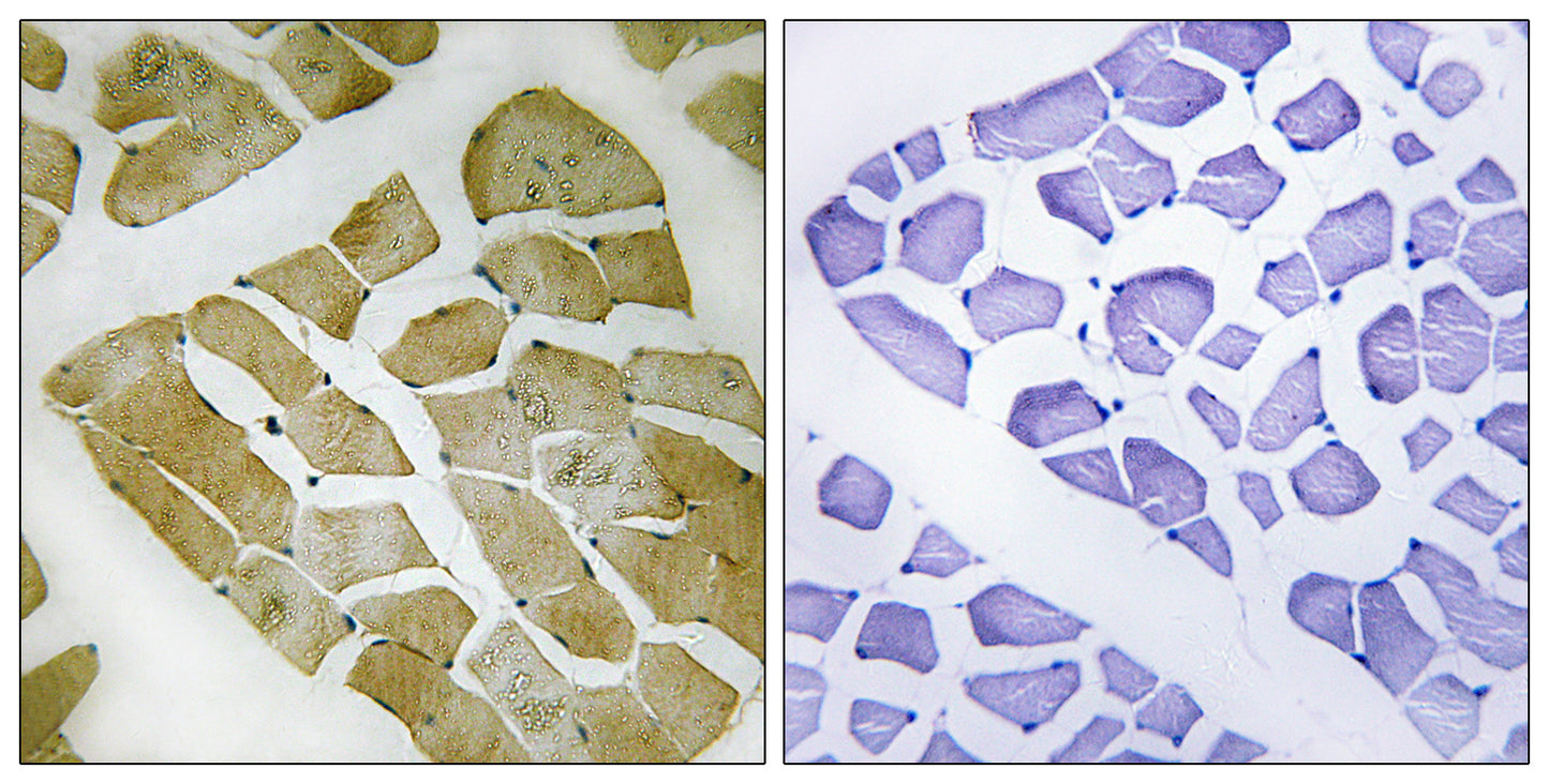 MYH4 Rabbit Polyclonal Antibody
