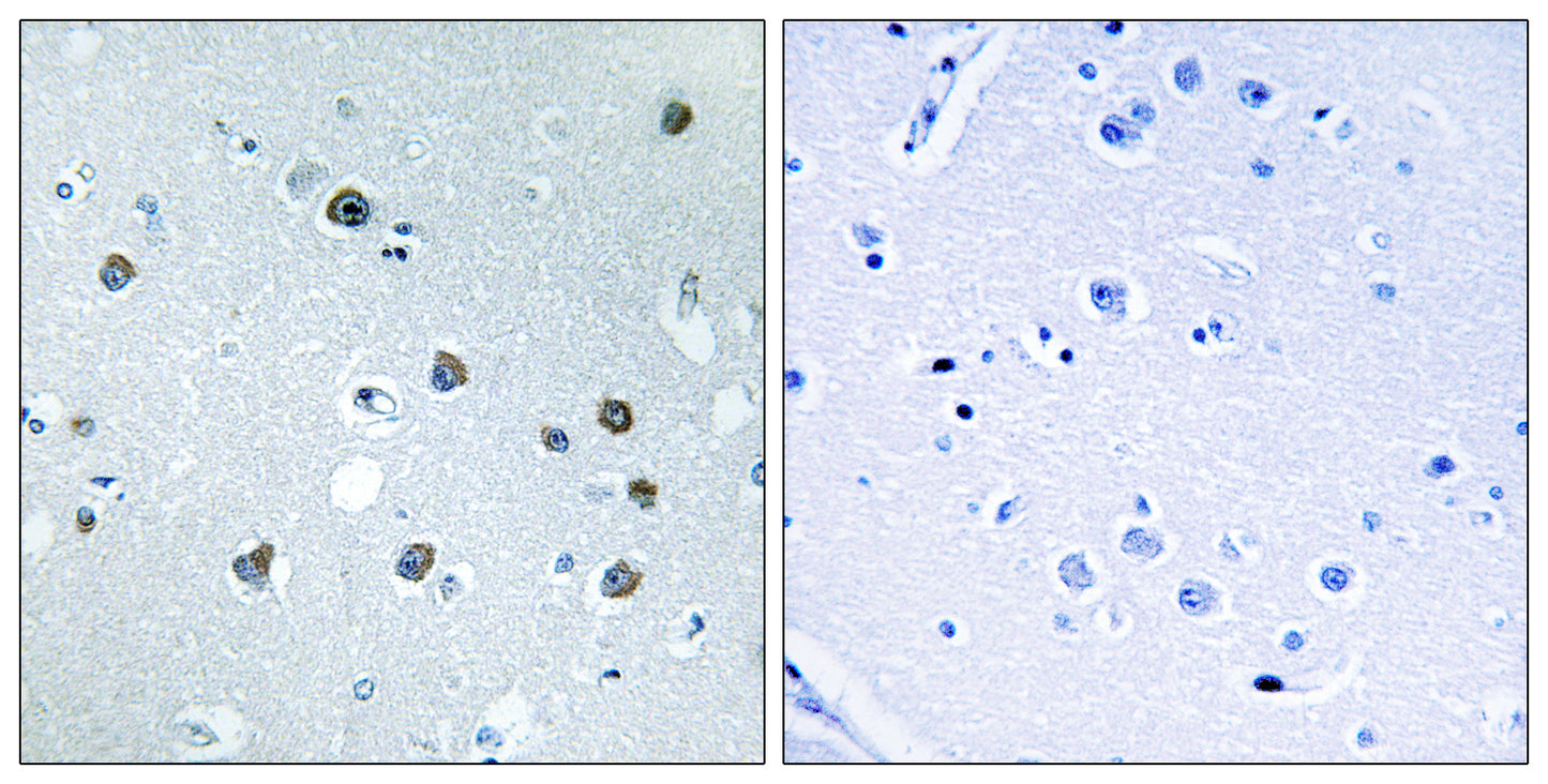 Myosin Id Rabbit Polyclonal Antibody