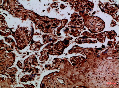 NAIP Rabbit Polyclonal Antibody