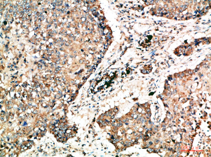 Napsin A Rabbit Polyclonal Antibody