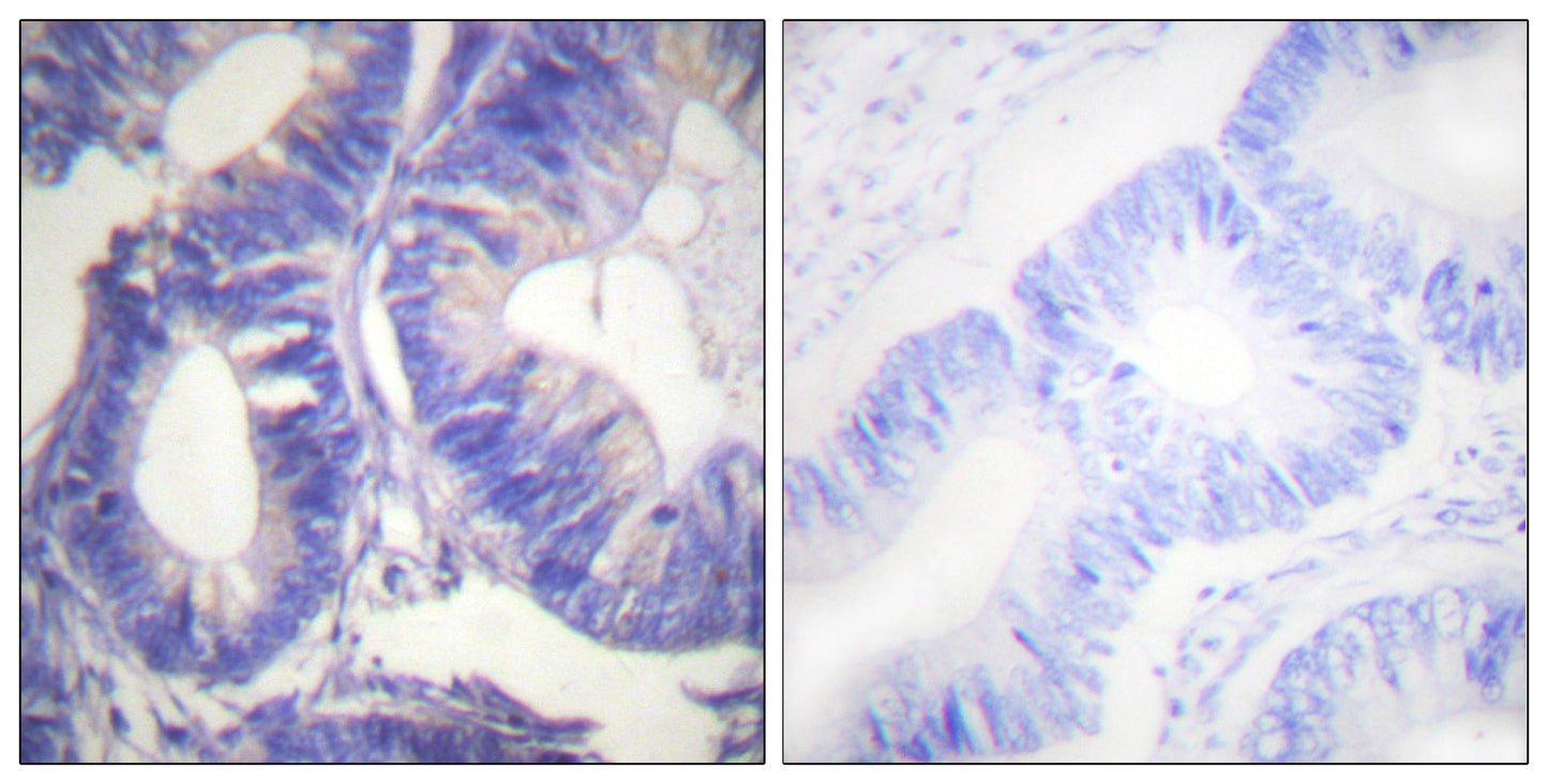 Nck-2 Rabbit Polyclonal Antibody