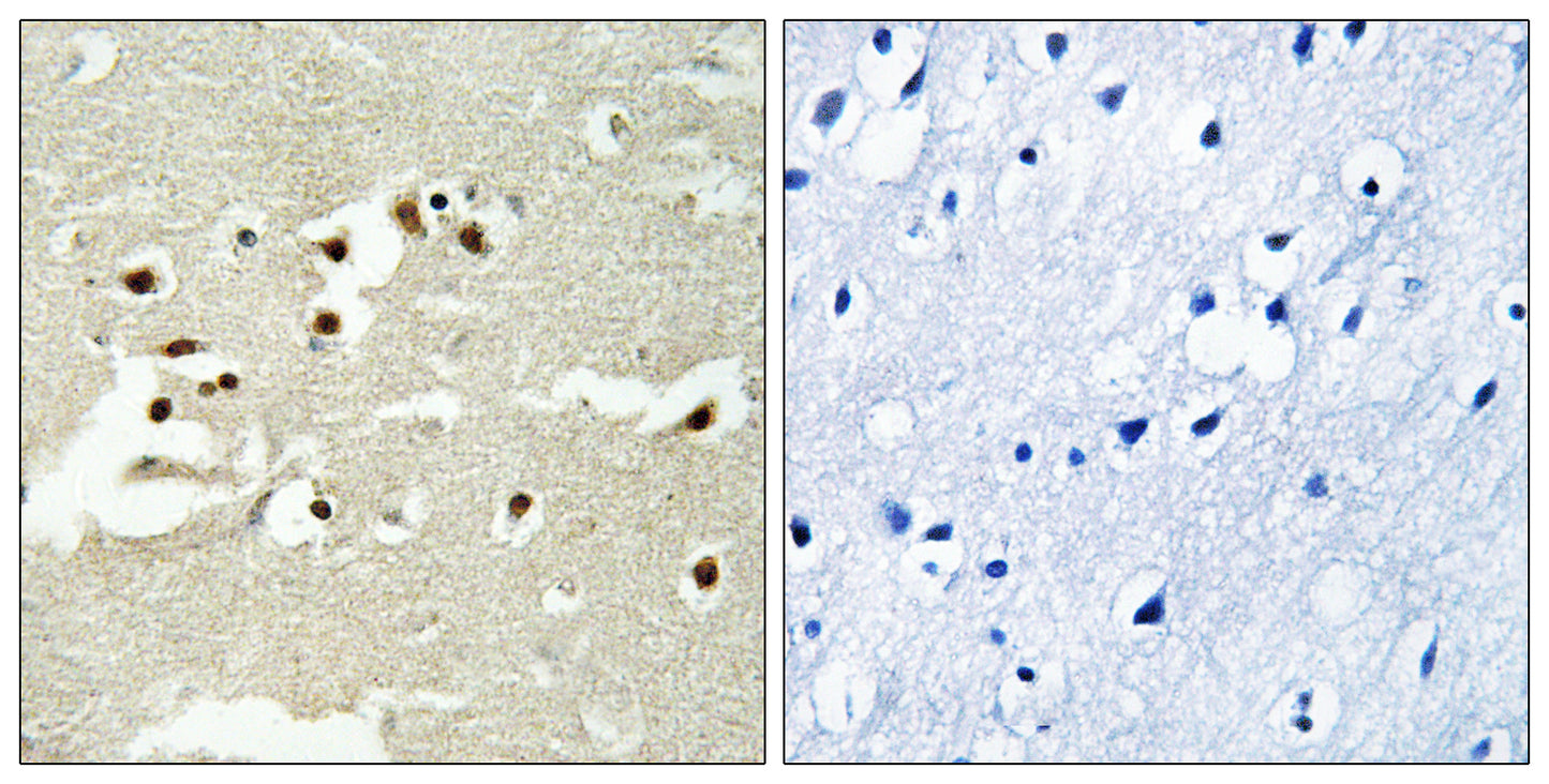NCoA-5 Rabbit Polyclonal Antibody