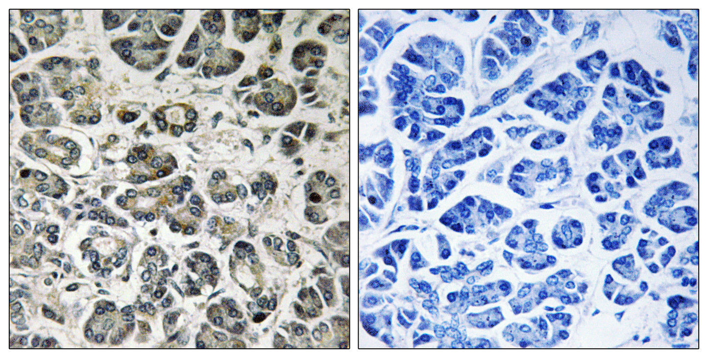 NDUFA8 Rabbit Polyclonal Antibody